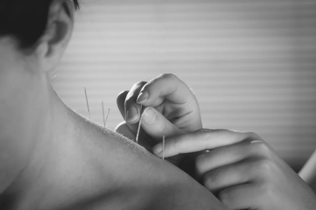 Pemberton Acupuncture
